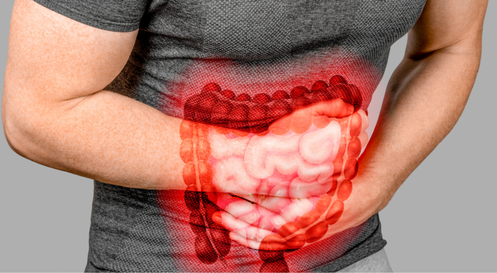 Síndrome do Intestino Irritável Tratamento com Microfisioterapia em Sorocaba